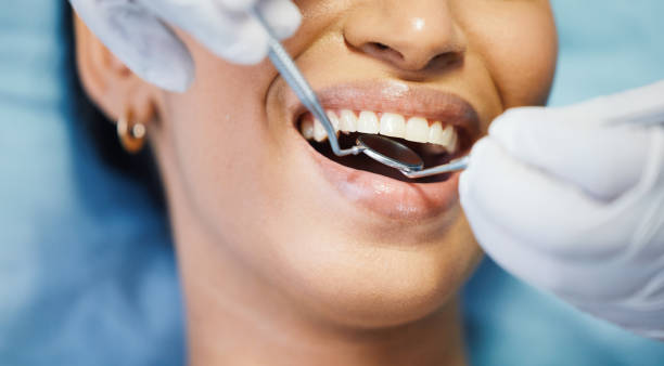 Best Walk-In Emergency Dentist in Carencro, LA