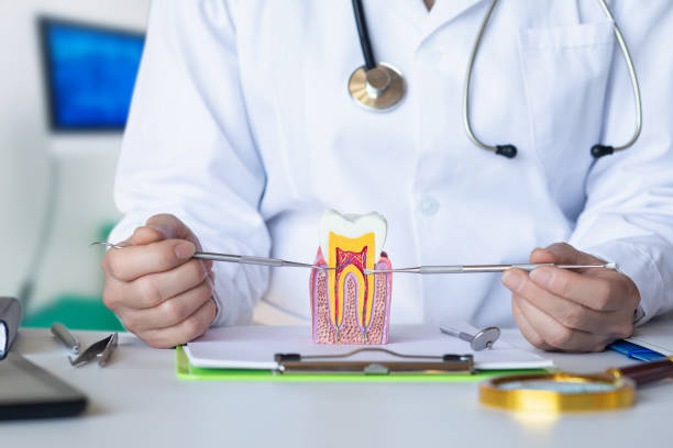 Best Emergency Tooth Extraction in Carencro, LA